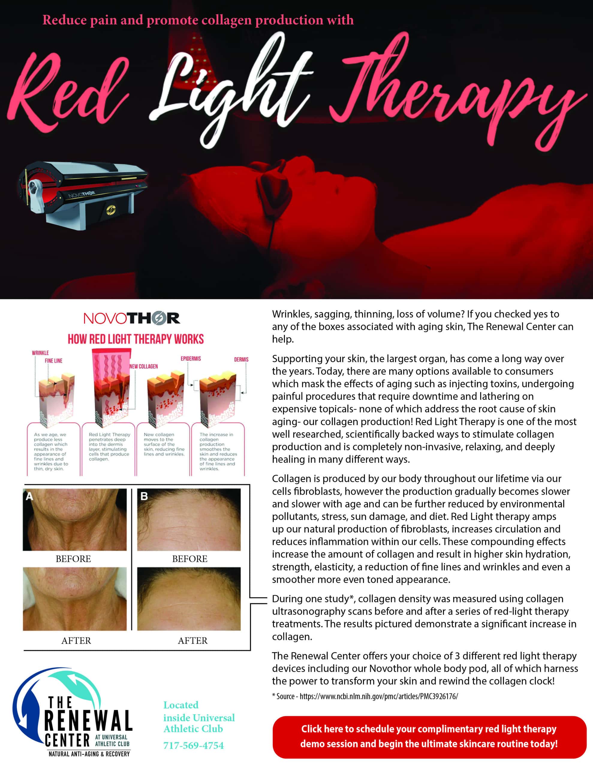 Red Light Therapy | Universal Athletic Club